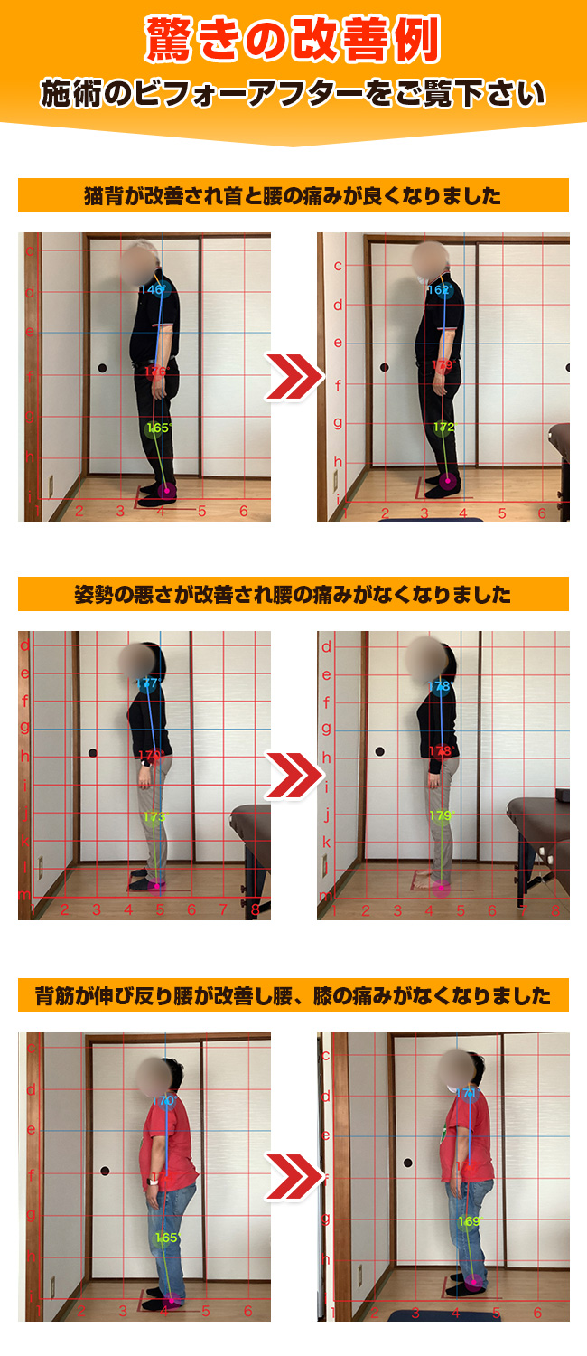 施術のビフォーアフターをご覧下さい
